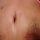 goopy slit of a belly button