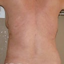 My back looks so good