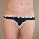 Full body as I had my inner thighs done too