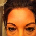 My old eyes, pre surgery