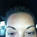 My new eyes one week after surgery