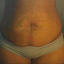5 days after