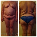 9 weeks and 2 days until my mommy makeover!