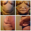 9 weeks and 2 days until my mommy makeover!