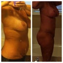 Before/6 weeks