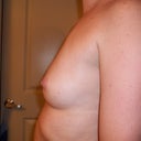 before pic