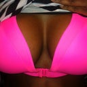 10 day breast augmentation... Breast are starting to drop in place .