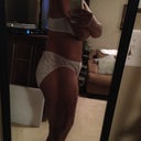 Pre-op 5 days to surgery