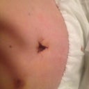My belly button:) very few stretches!!!