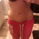4 months post op
