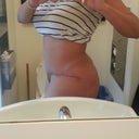 12 Weeks PO - taken in same mirror as pre-op photos