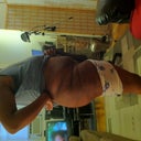 3 Weeks Post Op!!
