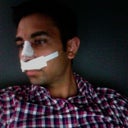 Day 2 - Profile. Nose already looks smaller!