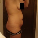 Before - Left