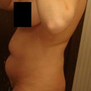 Before - Right