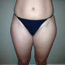 Before Front