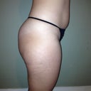 Before Side
