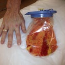 Fat removed