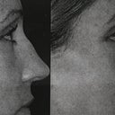 Before and computer generated after