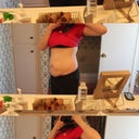2 weeks pre-op - December 24, 2011