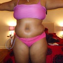 Pic of new belly day 7. Down to one drain. Extremely swollen