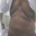 Before the surgery