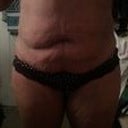 10 days post op