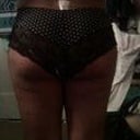 10 days post op