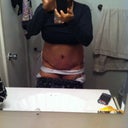 1st day post op