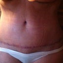 I think my scar is doing good.