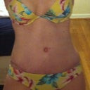 Day 18 PO. Bikini pic. You can see my scar on the sides. Hope it fades to invisible b/c I'm liking my shape. :-)