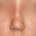 tip upturned and nostrils uneven