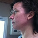 4 weeks post op