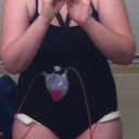 2 Days PO. Wearing the CG and a black sports bra...with the 2 drains coming out from each hip.