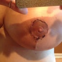 RIGHT ONE HEALING