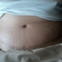 1 mo po