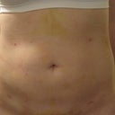 after 4 days front