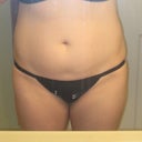 before - front view.
i feel so boxy so hope to get some curves on the sides...