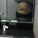 Front before bbl 5'4 @ 201lbs (dieting to get to 170-175)