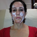 Pre-treatment with numbing cream.