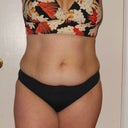 front view before