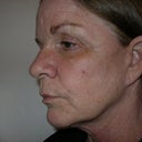 March 11, 2012. Neck skin bands are back and jowls hanging.