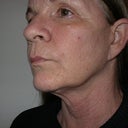March 11, 2012. Side View.