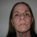 What I look like today after a year and a half. 
Front View.