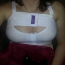 day of 2nd surgery left boob fixed