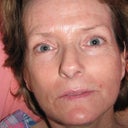 29 days, post-procedure