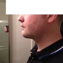Almost 2 months after