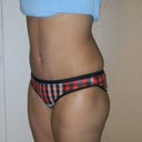 Post Op 4 Weeks