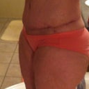 7 weeks po