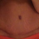 7 weeks po